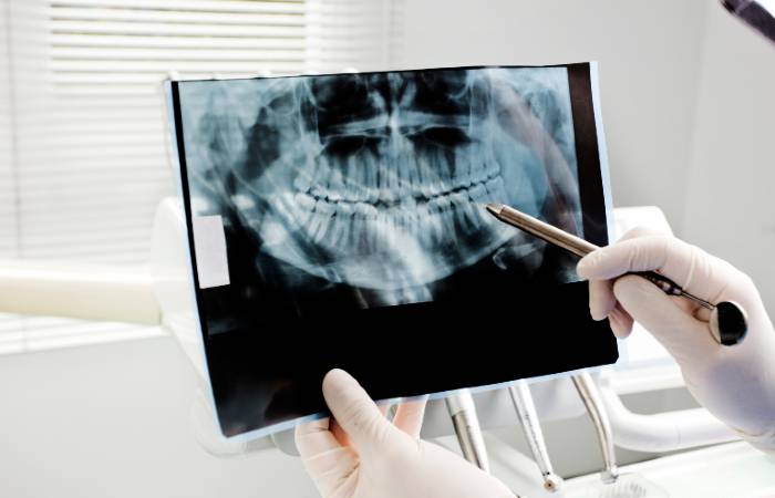 Teeth X-ray